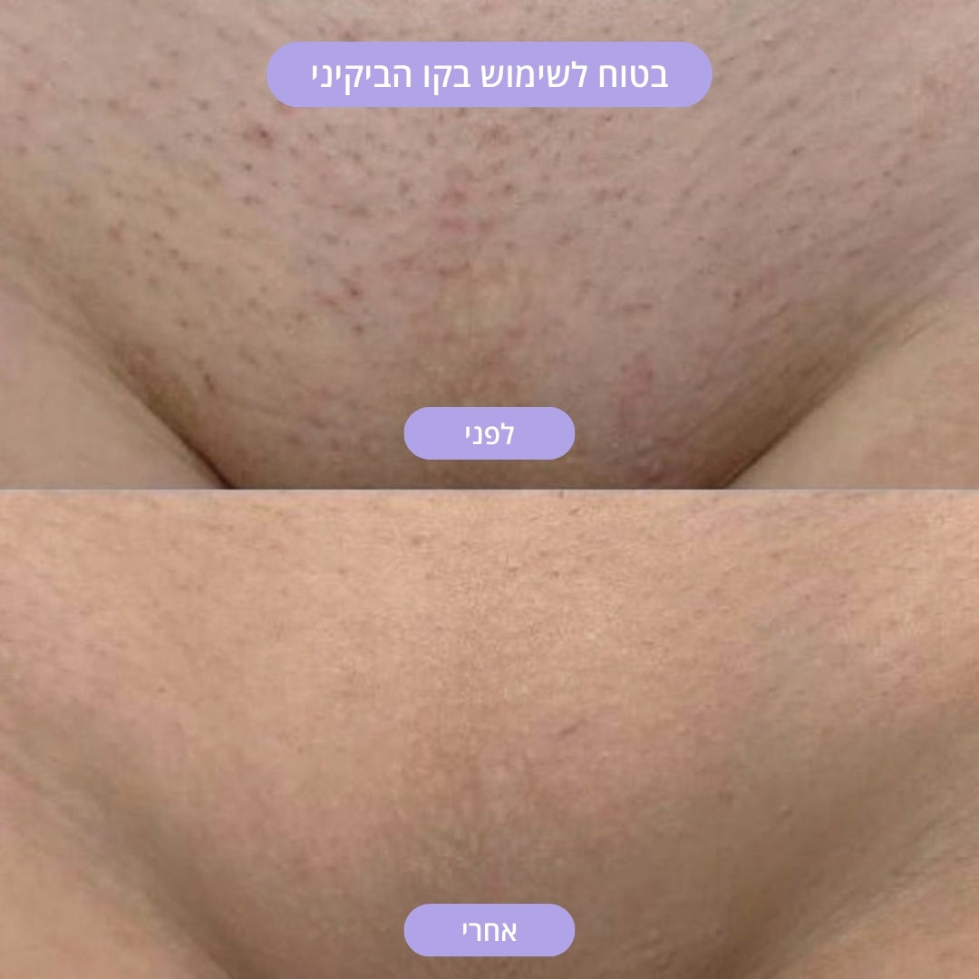 מכונת הגילוח של LAOR