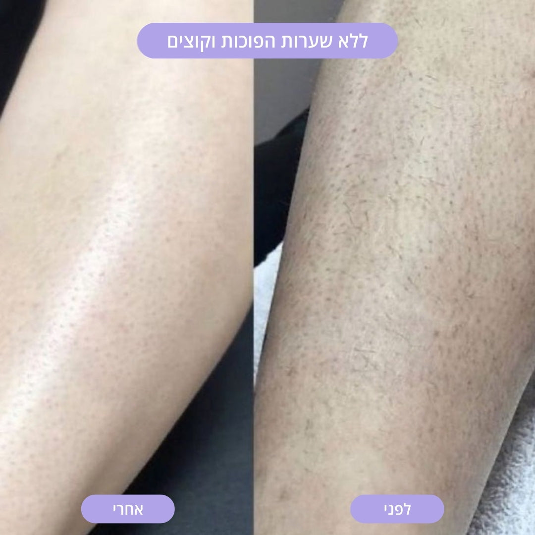 מכונת הגילוח של LAOR