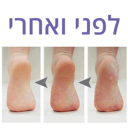 מסיר עור מת חשמלי